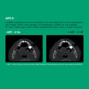 Système d’imagerie 4-en-1 3D / 2D - Green 2 - Vatech - Safe Implant